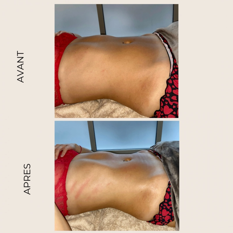 Coralie Blanchard Drainage Lymphatique Orleans Realisation 10