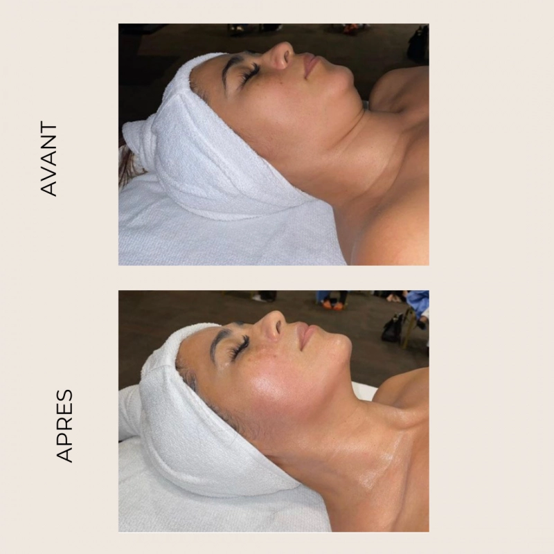 Coralie Blanchard Drainage Lymphatique Orleans Realisation 3