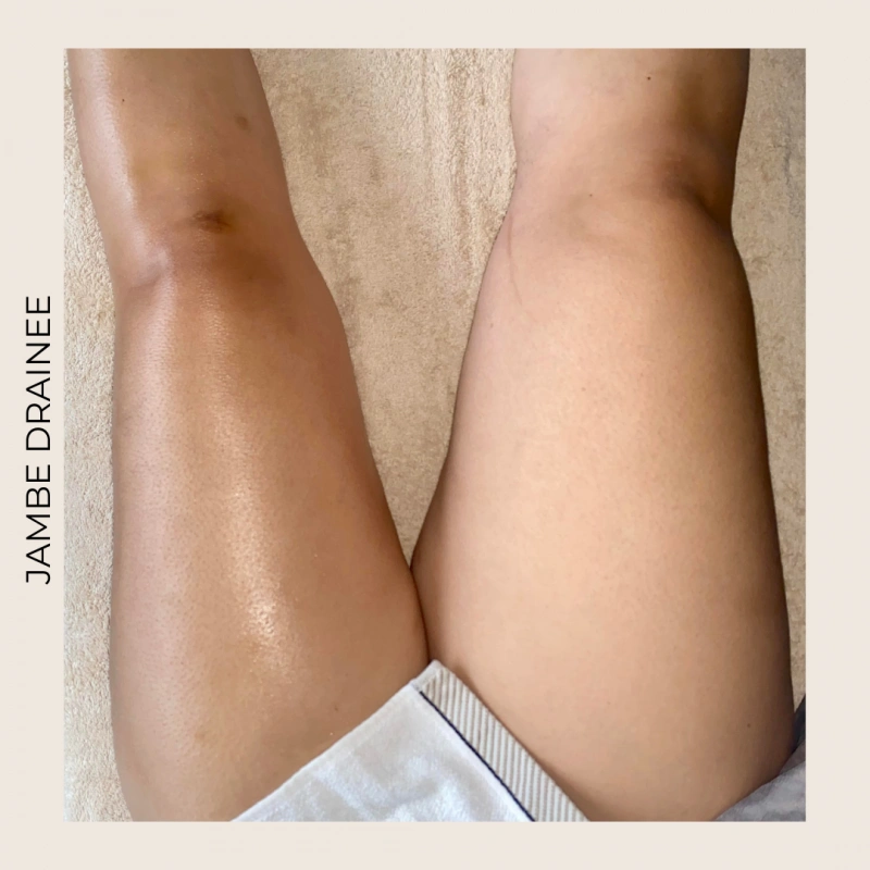 Coralie Blanchard Drainage Lymphatique Orleans Realisation 4