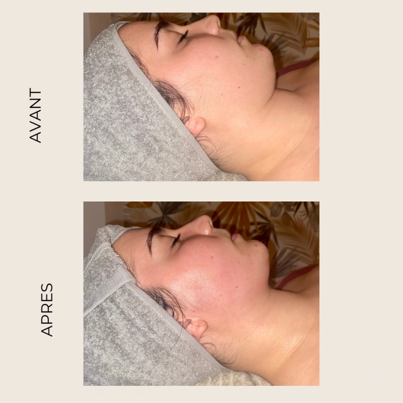 Coralie Blanchard Drainage Lymphatique Orleans Realisation 5