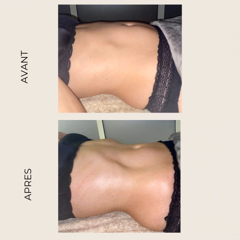 Coralie Blanchard Drainage Lymphatique Orleans Realisation 9